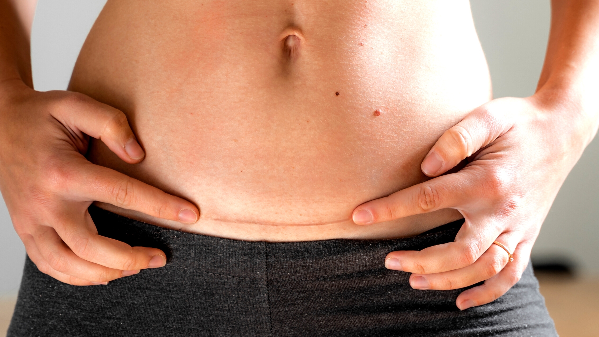 Normal Pregnancy